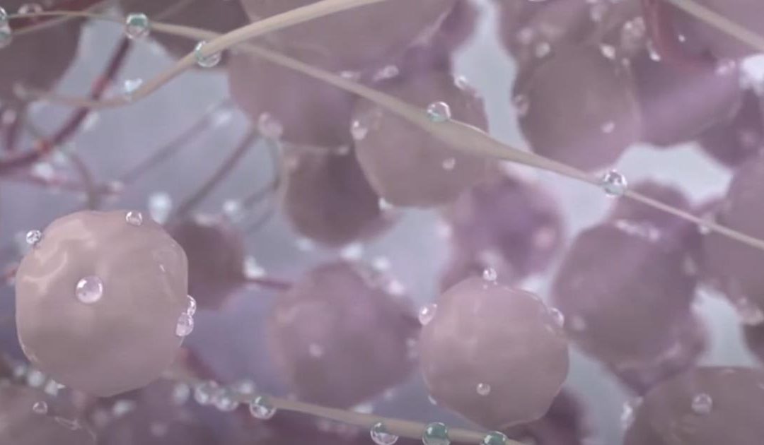 Water Vapor Therapy for Benign Prostatic Hyperplasia (BPH)